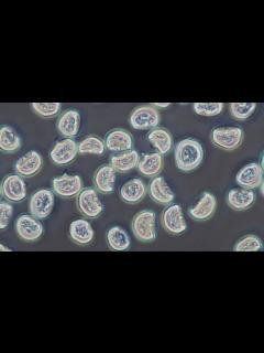 [x]スギ花粉の顕微鏡観察 - YouTube