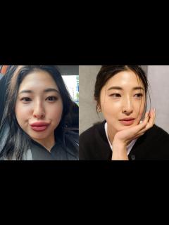 [x]顔に何をやったか全て話します。 - YouTube