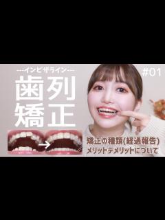 [x]痛い？大変？歯列矯正を始めて感じたメリットデメリットを話します。【#1/インビザライン