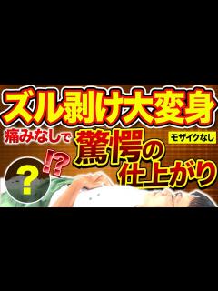 [x]【モザイクなし】皮被りに別れ！ズル剥けに変身するまでノーカット密着！【包茎手術】 - YouTube